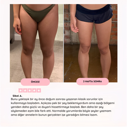 Scalya Fit™ Uyluk & Pelvik Egzersiz Aleti